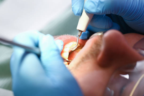 Best Tooth Infection Emergency Dentist  in Overland, MO